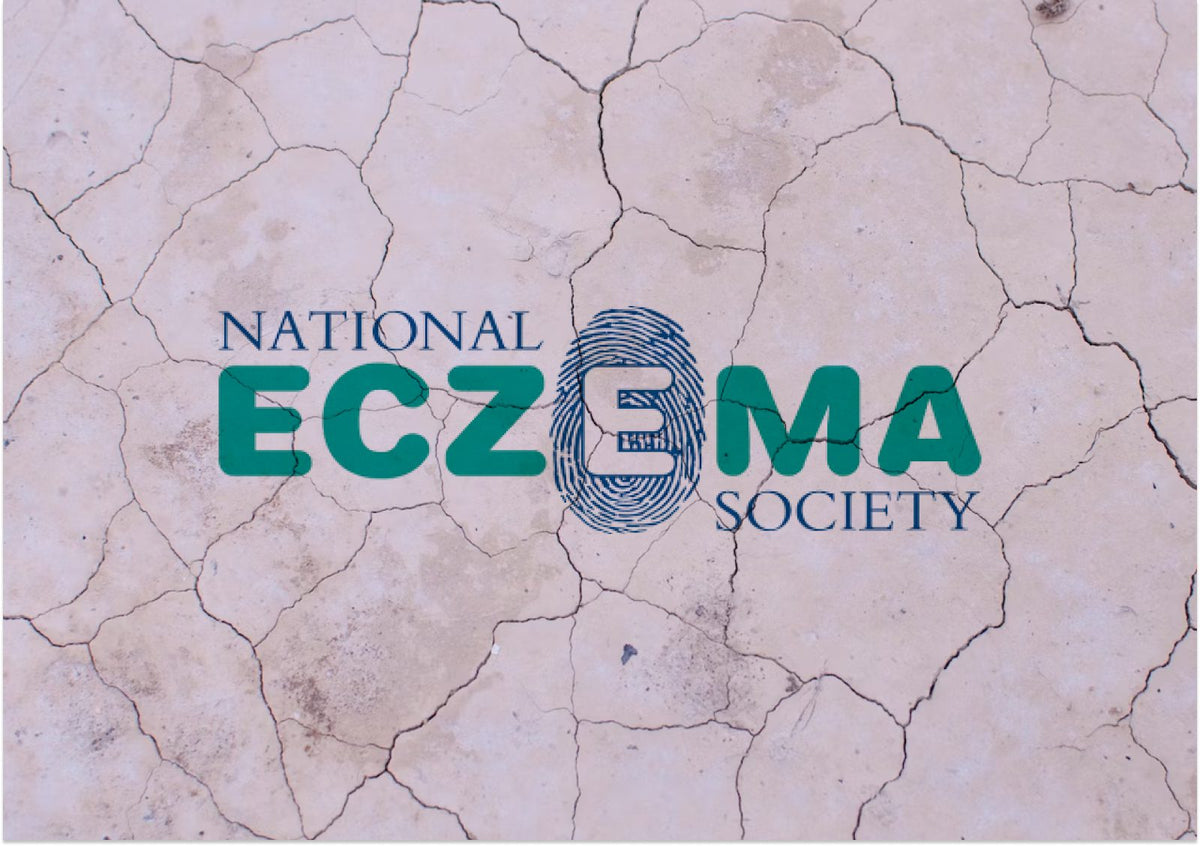 Nurturing Skin During UK National Eczema Awareness Week: Embrace Relief with Goat Milk Skincare
